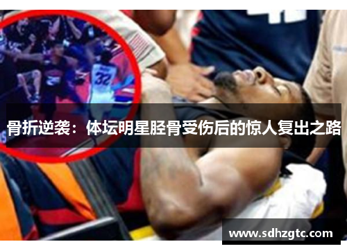 骨折逆袭：体坛明星胫骨受伤后的惊人复出之路